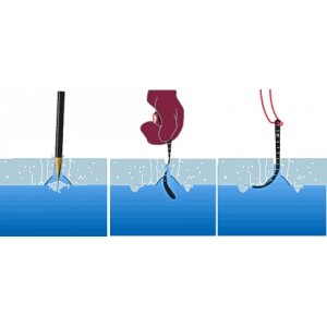 Ice Gauge